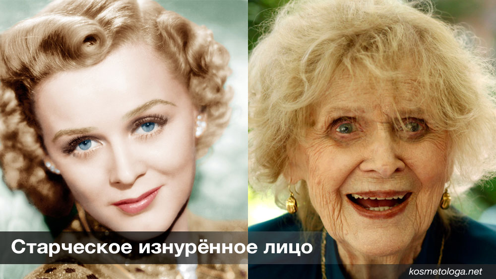 http://kosmetologa.net/wp-content/uploads/2015/04/very-old-aging-type-kosmetologa-net.jpg