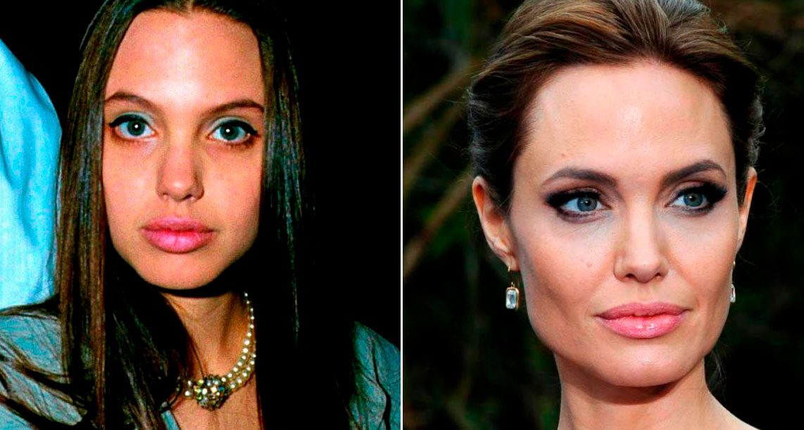 Кстати, нос Анжелины Джоли, тоже несколько раз сделаный и не её родной.