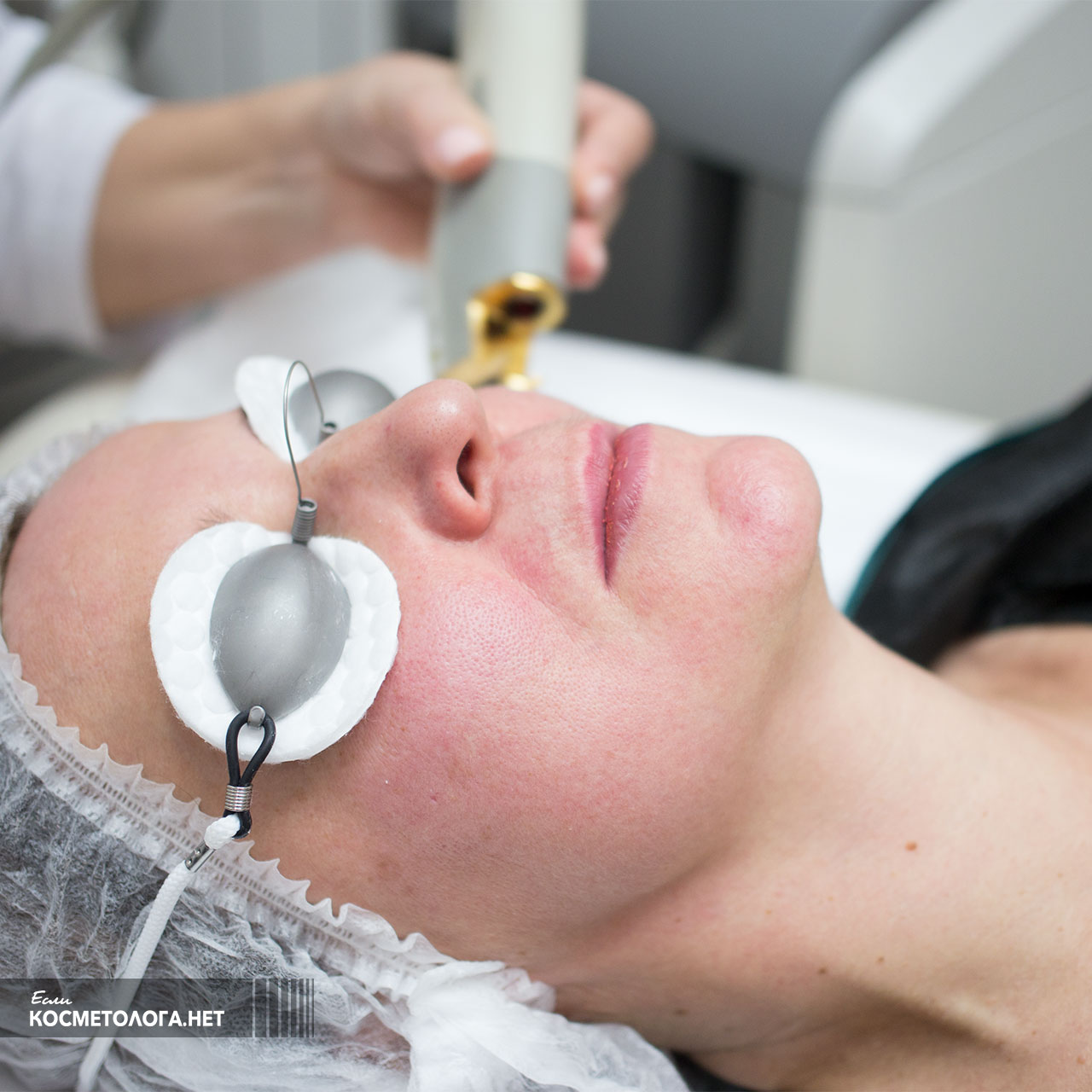 Косметолог выполняет процедуру Laser Genesis и кожа постепенно краснеет